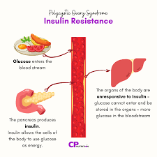 Insulin Resistance