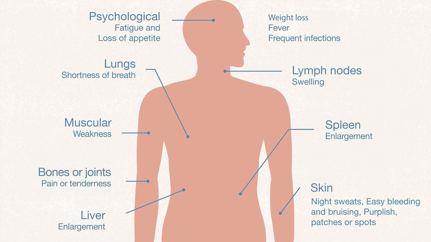 leukemia symptoms image