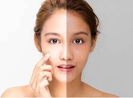 brightening skin image