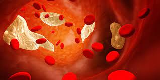 Cholesterol images