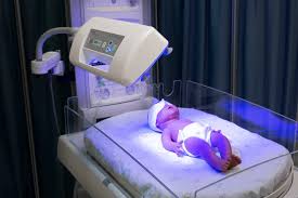 phototherapy for jaundice