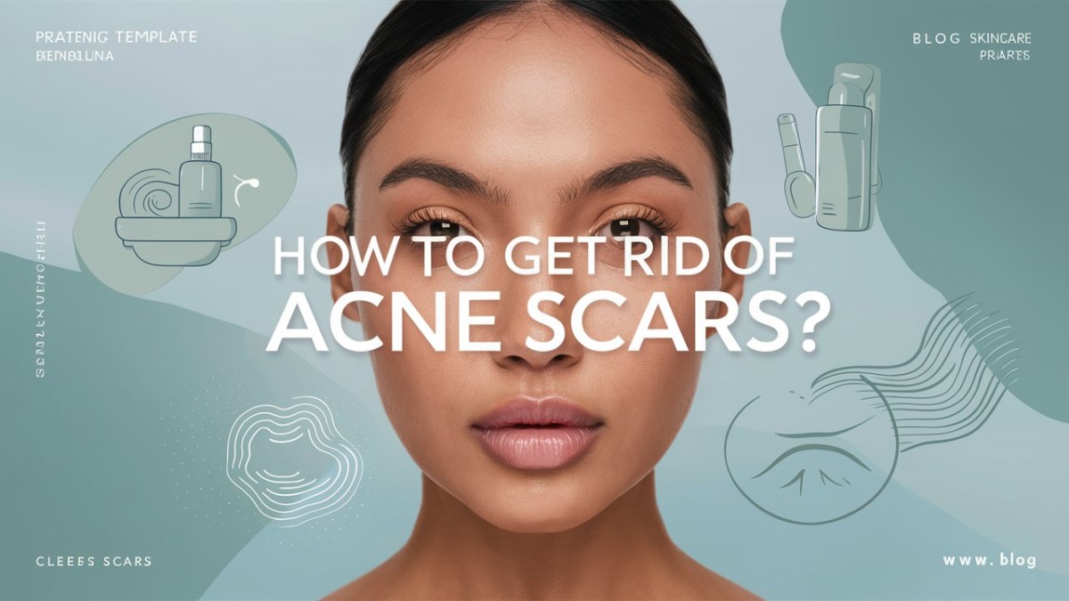 This is an image for topic How To Get Rid of Acne Scars?