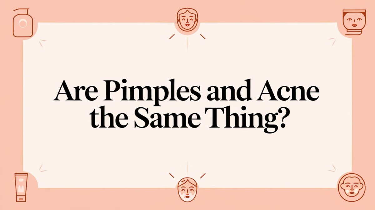 This is an image for topic Are Pimples and Acne the Same Thing?