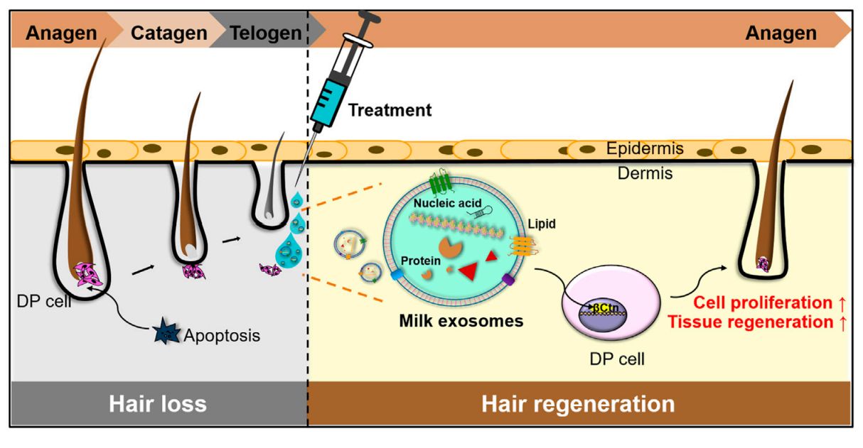 Exosome Therapy in Hair Care 