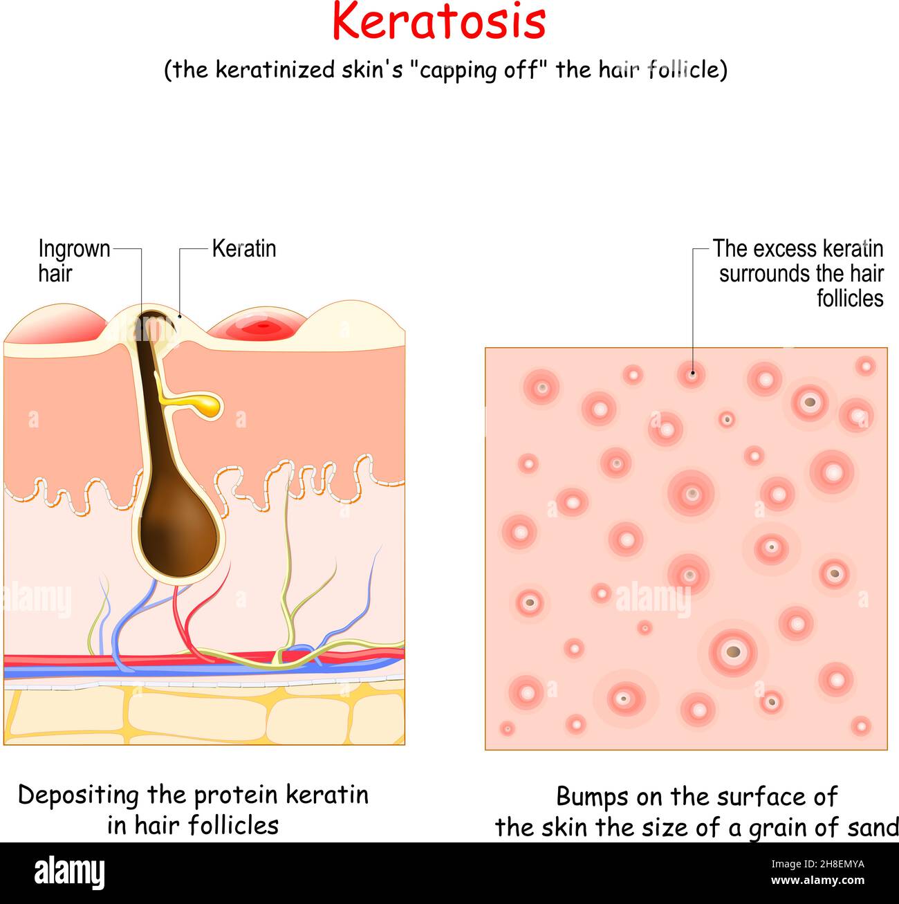 Keratin Protein 
