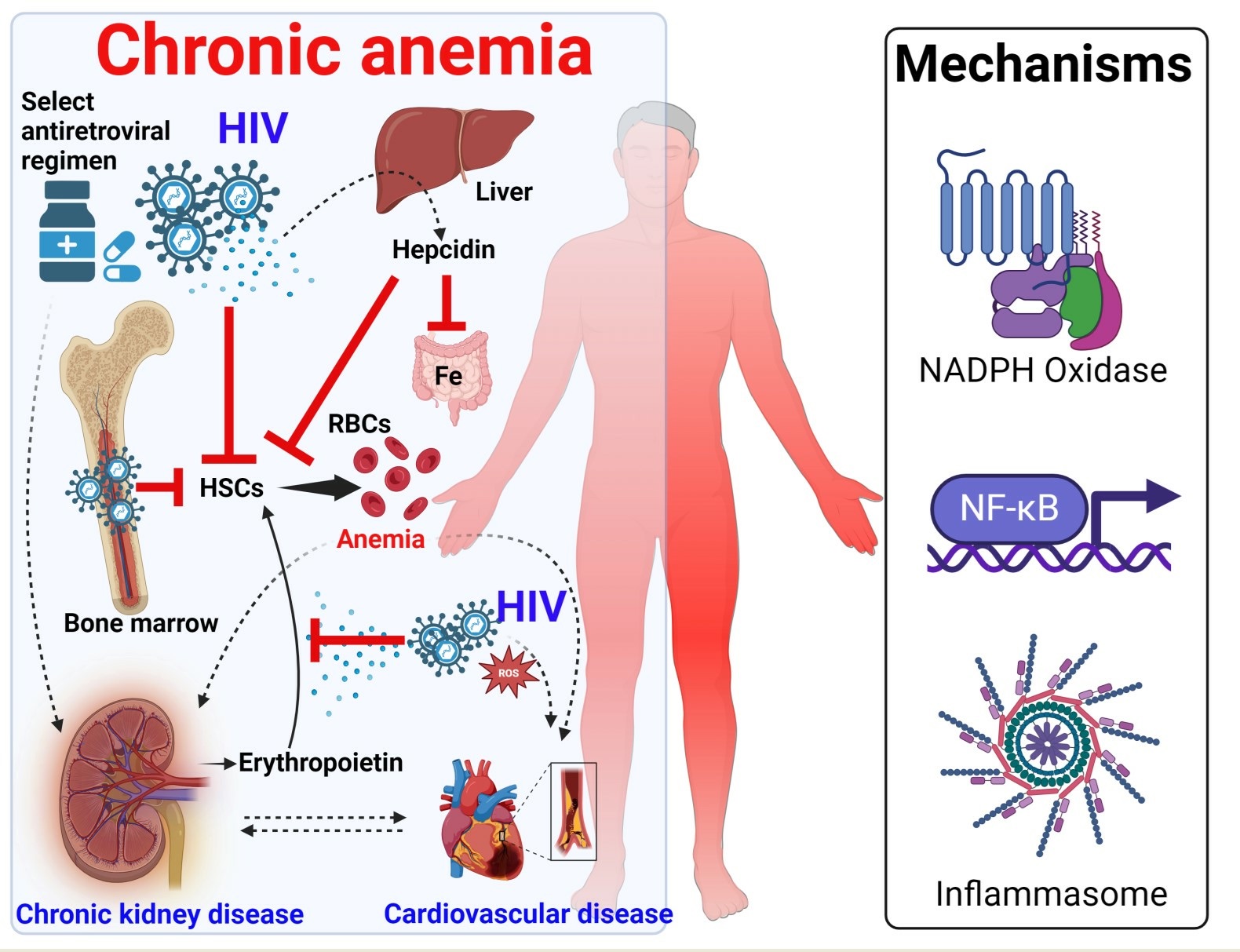 Anemia of Chronic Disease