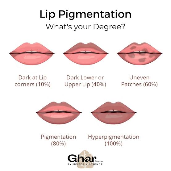Different categories of lip pigmentation 