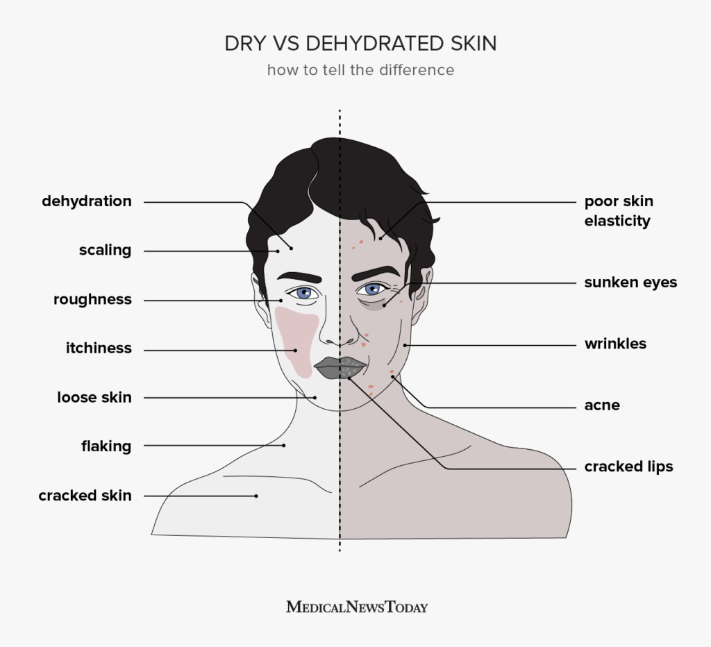 Difference between Dehydrated and Dry Skin 
