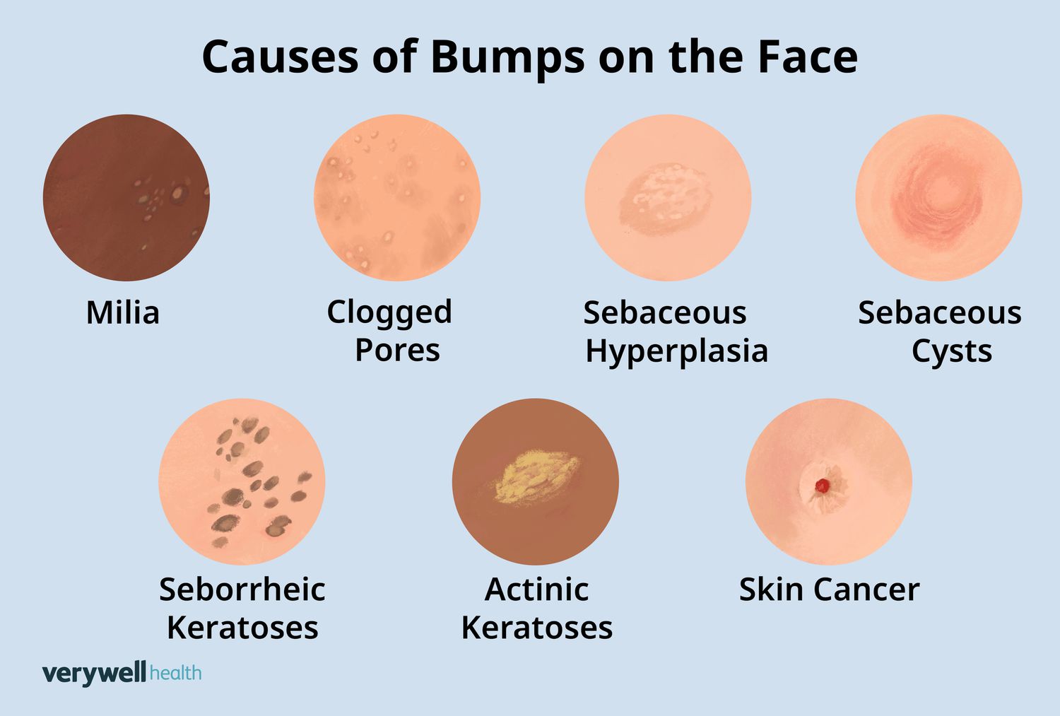 Different types of tiny bumps 